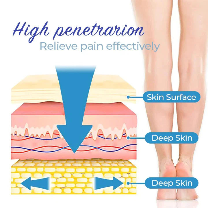 Krampfader-Spray (1 + 1 KOSTENLOS)