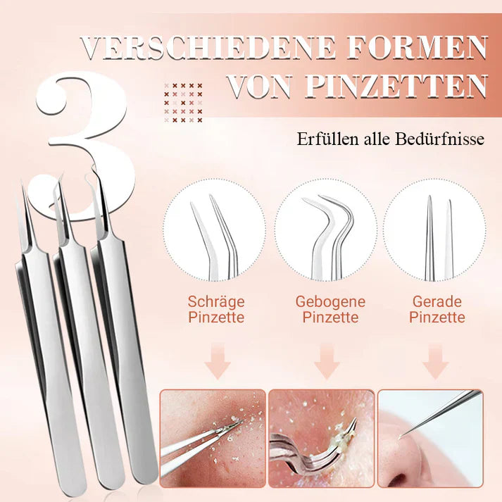 DermaTool™ – Präzise Entfernung von Mitessern