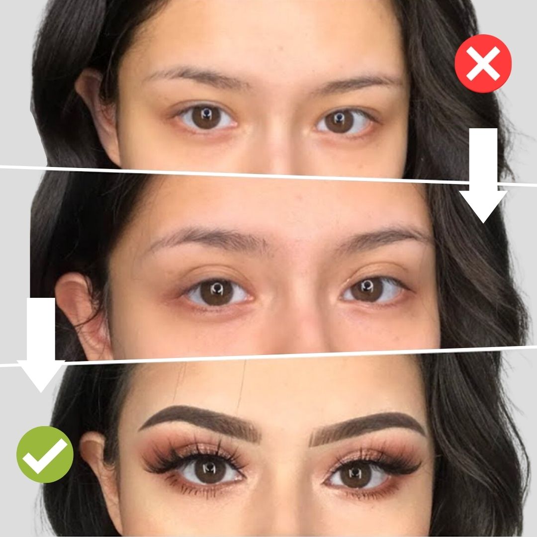 Brightie™ - Unsichtbare Lidstraffungsstreifen Kit | 1+1 Gratis