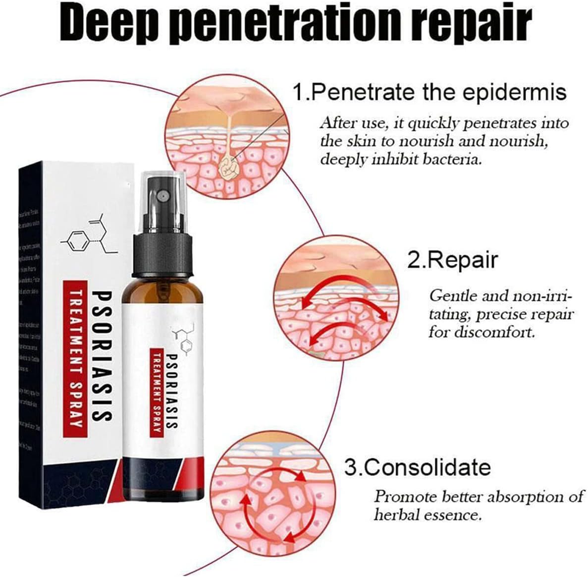 PsoriSpray™ | Spray gegen Schuppenflechte | Schnelle Linderung | 1+1 Gratis