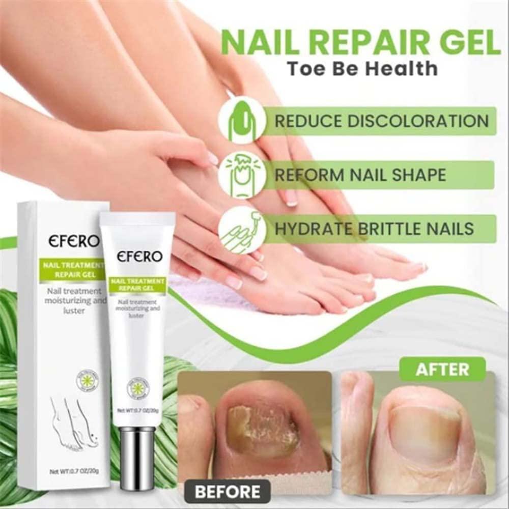 1+1 GRATIS | RejuveNail™ - Steigert die Kraft für gesunde, schöne Nägel!