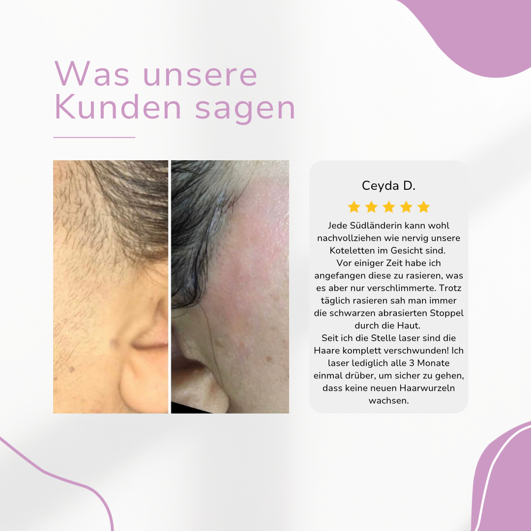 Ylvis IPL Hair Remover I Die führende Laser-Haarentfernung für Zuhause