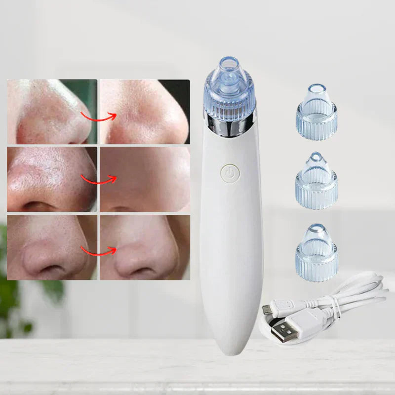 PoreCleaner™ | Für sichtbar reinere Haut in nur wenigen Minuten!