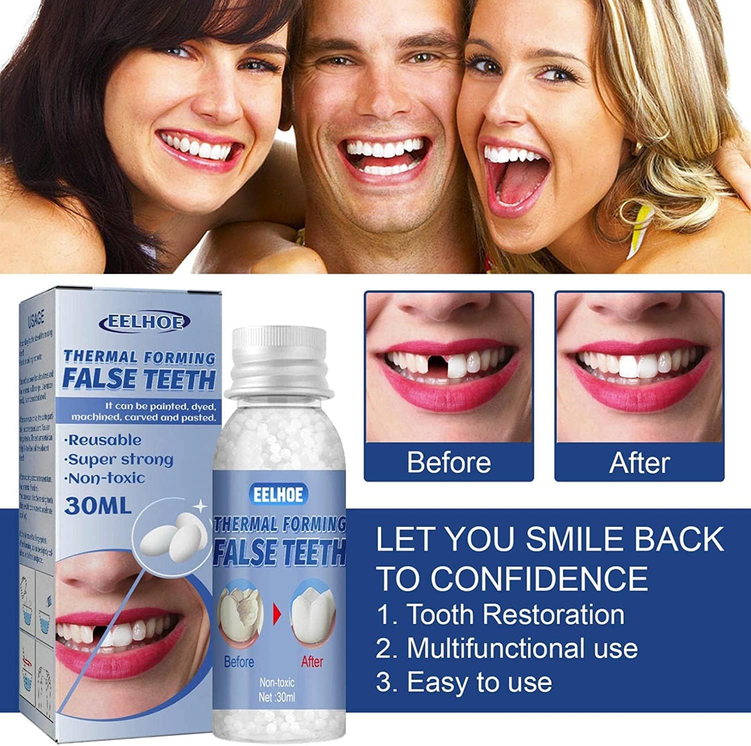 SmileRight Zahnreparatur Set | Sofort Zahnlücken Füllen | Natürliche Farbe | 1+1 Gratis