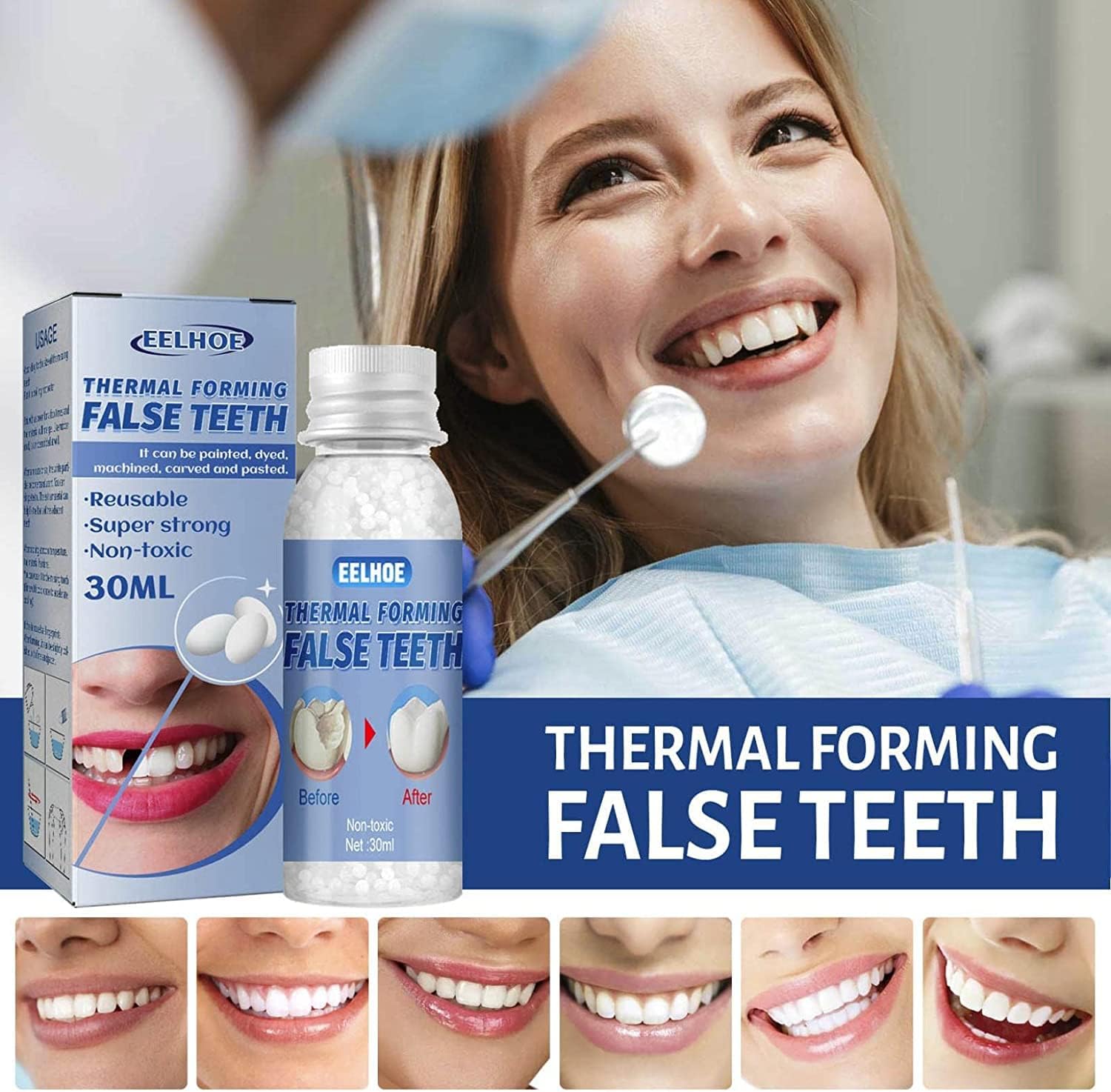 SmileRight Zahnreparatur Set | Sofort Zahnlücken Füllen | Natürliche Farbe | 1+1 Gratis