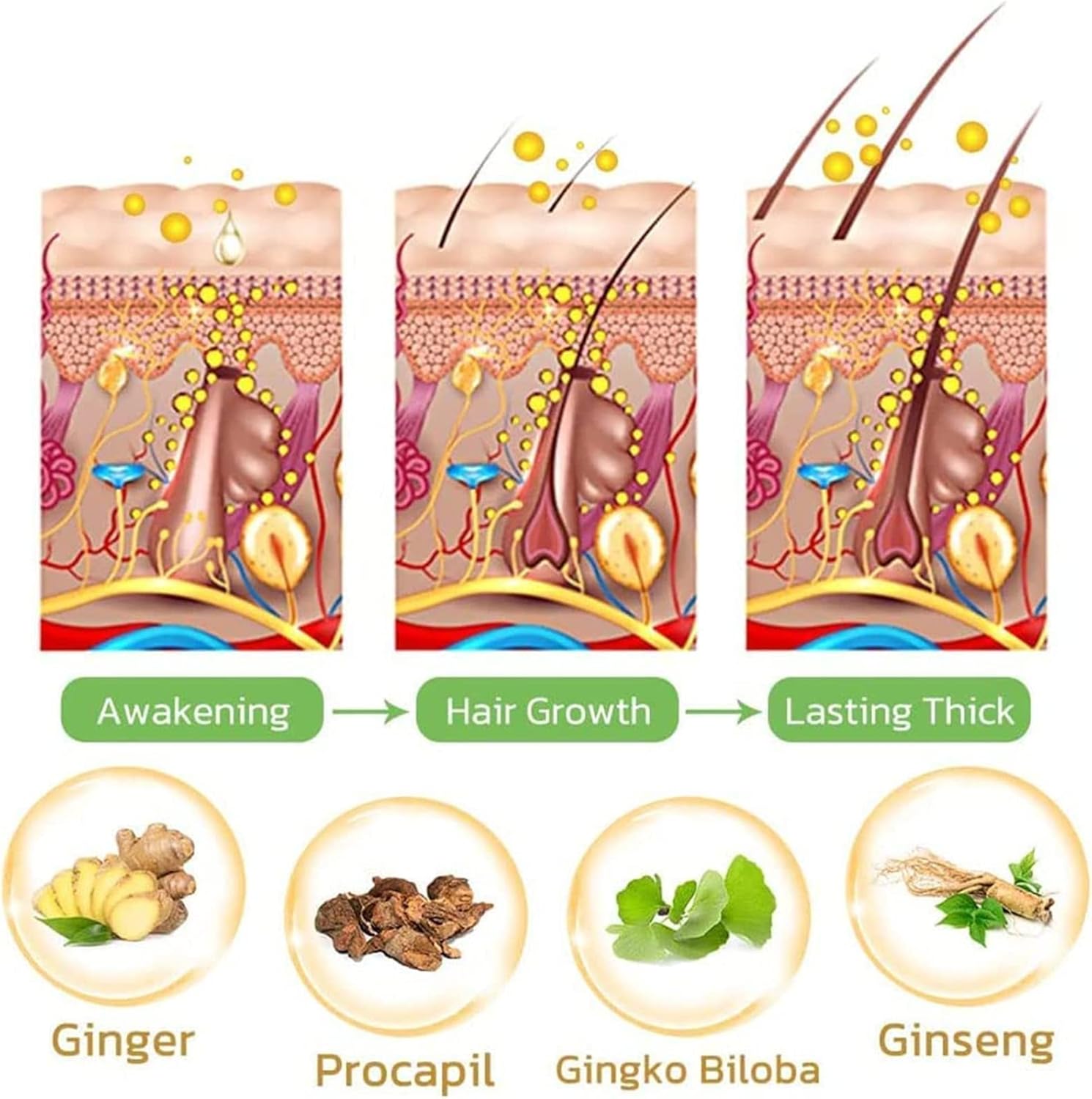 GingerGlow™ Haarwuchsspray | Ingwer & Minoxidil | Gegen Haarausfall