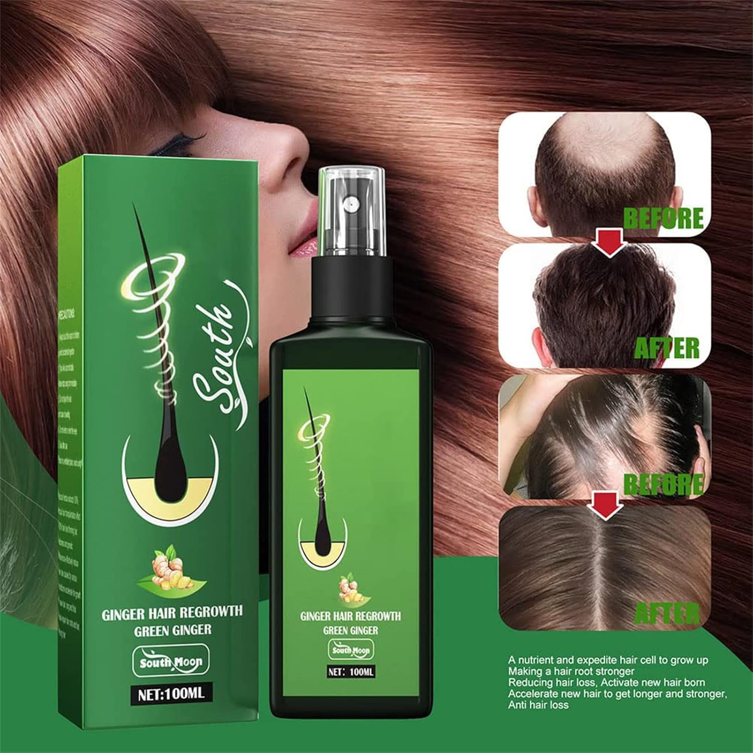 GingerGlow™ Haarwuchsspray | Ingwer & Minoxidil | Gegen Haarausfall
