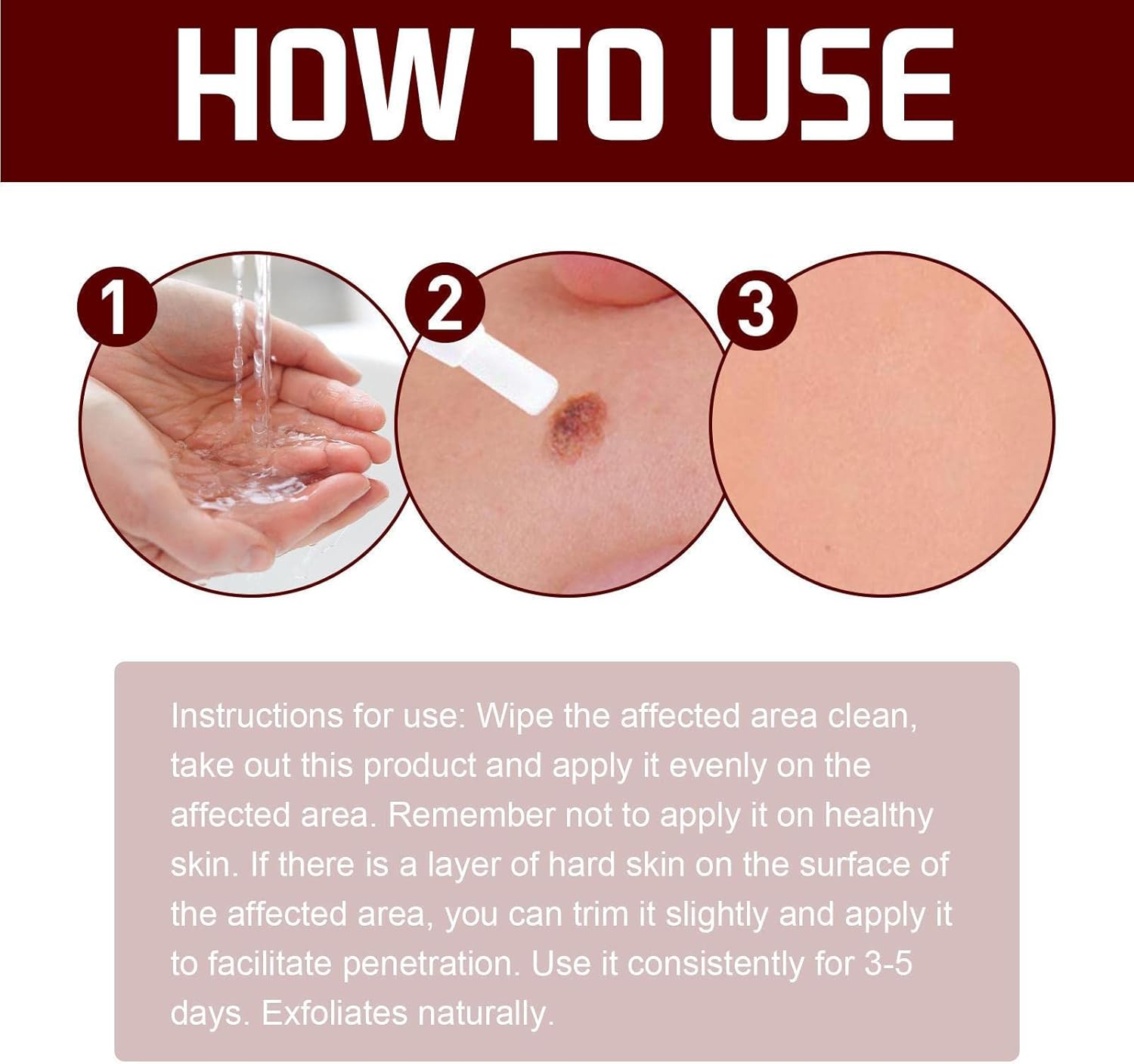 1+1 Gratis | SkinFix™ Sanfter Hautunreinheiten- und Muttermalentferner