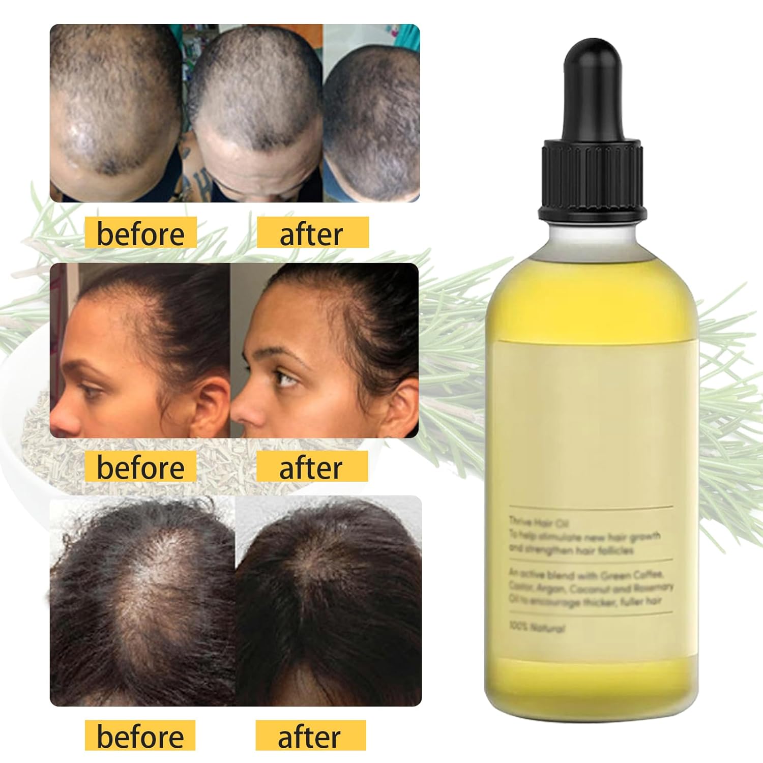 1+1 GRATIS | Haarwuchsöl | Pflanzliche Wachstumsformel | Sichtbar Dickeres Haar | Für Alle Haartypen