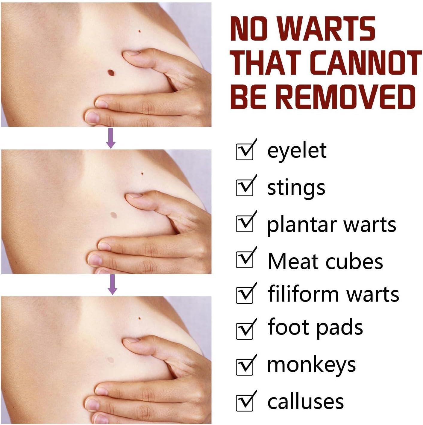 1+1 Gratis | SkinFix™ Sanfter Hautunreinheiten- und Muttermalentferner