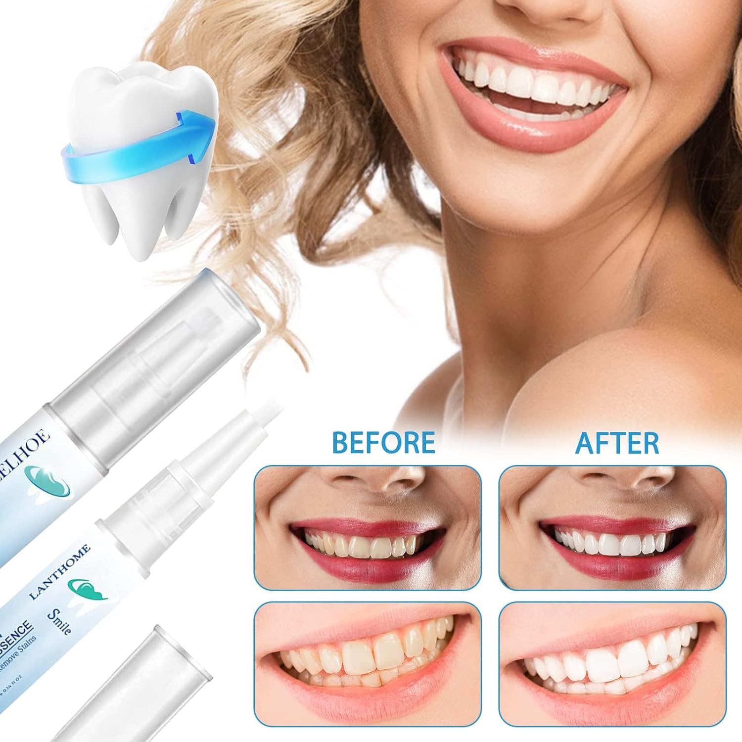 1+1 Gratis | Brighton™ Fortschrittlicher Zahnaufhellungsstift