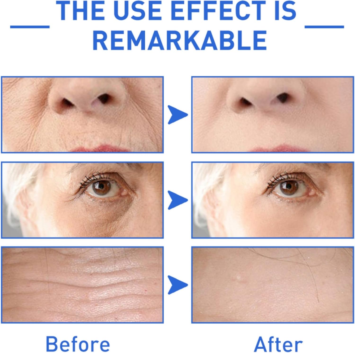 1+1 Gratis | GlowVive™ Straffe, strahlende Haut ohne Operation