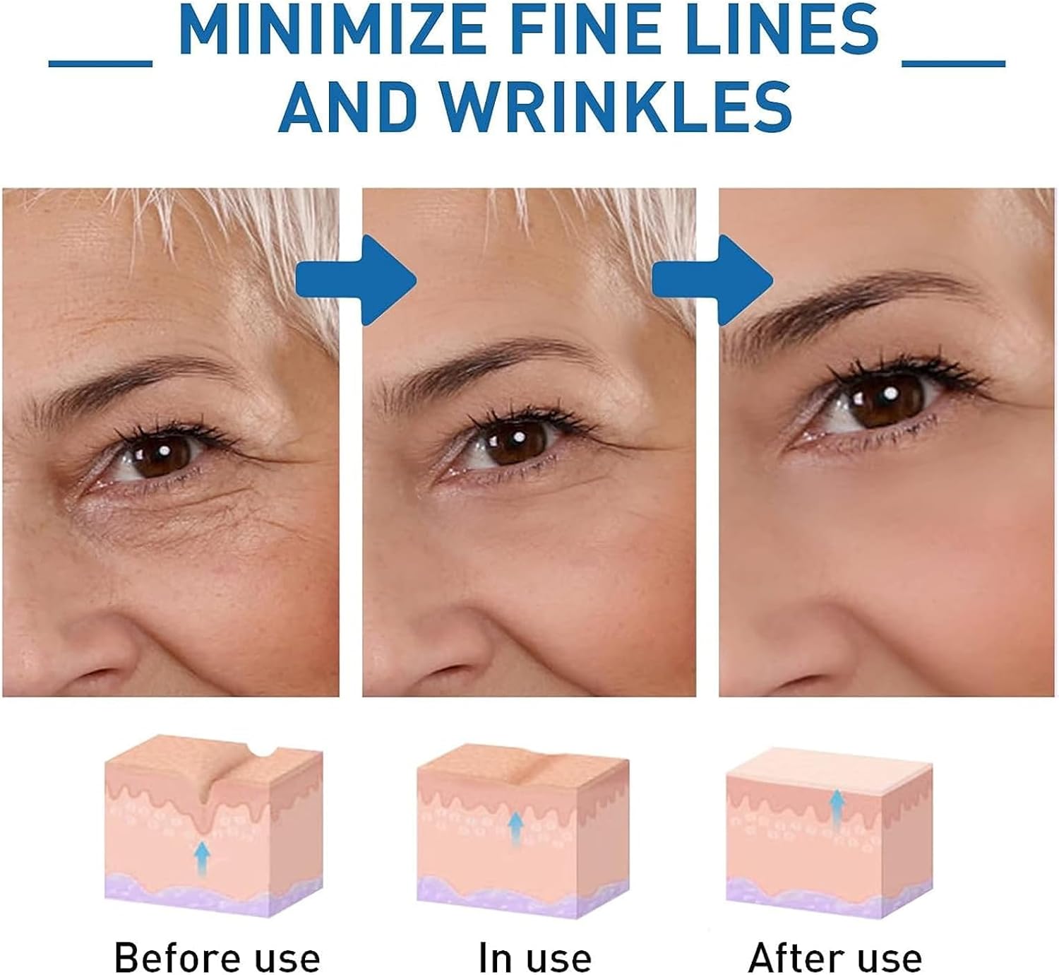 1+1 GRATIS | Hyalu™ Jugendliche Ausstrahlung wiederherstellen