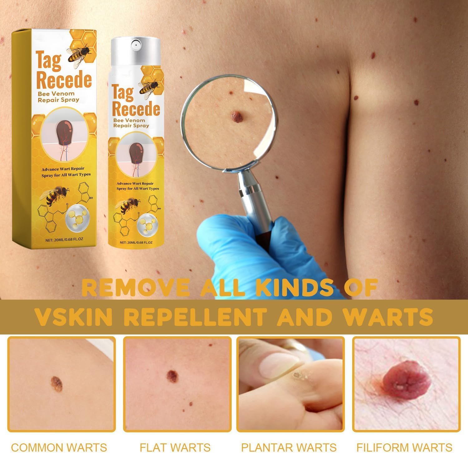 TagAway Warzen Entferner | Bienengift Formel | Effektiv & Schonend | 1+1 Gratis