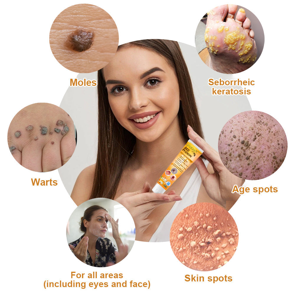 NEWYOU TagLift Creme | Bienengift Hautbehandlung | Schmerzfreie Warzen- & Muttermalentfernung | 1+1 Gratis