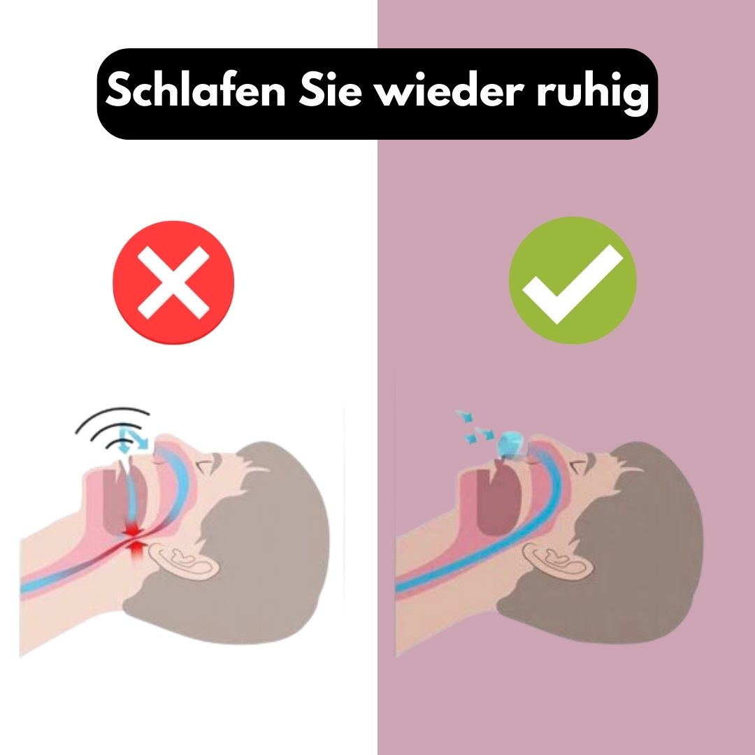 😴 SleepRelief™ – Sag dem Schnarchen endgültig Lebewohl! | 1+1 Gratis