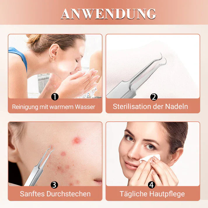 DermaTool™ – Präzise Entfernung von Mitessern