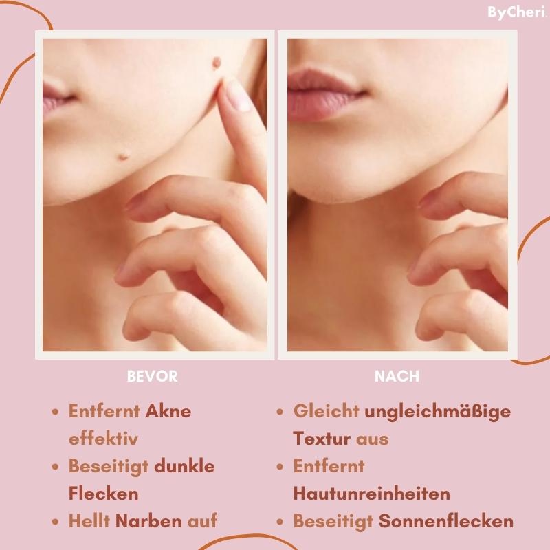 FlawlessFade™ | Verabschieden Sie sich von Hautunreinheiten