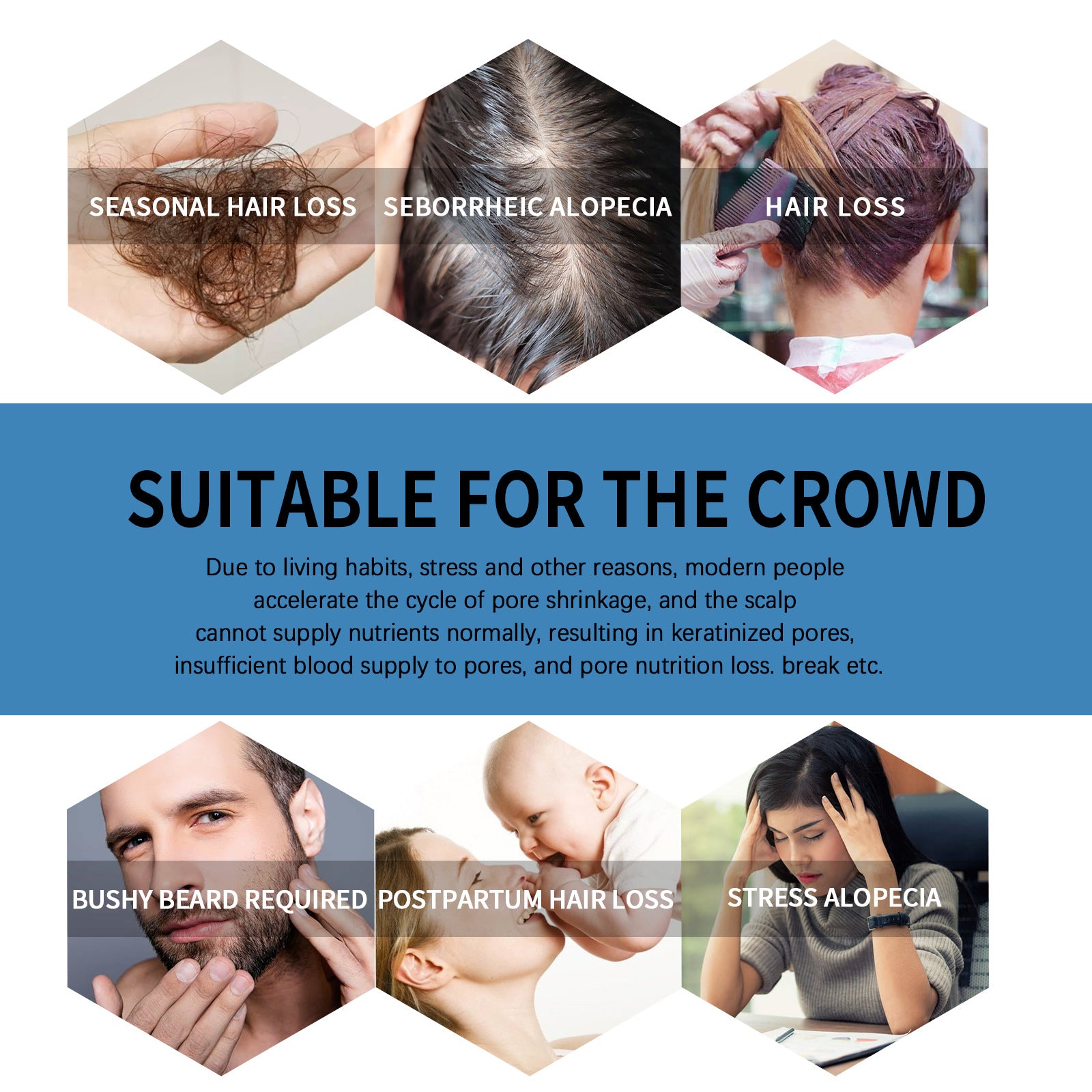 1+1 GRATIS | Haarwuchs Roll-On | Mit Minoxidil, Biotin & Glycerin | Gegen Haarausfall | Praktische Anwendung |GlowMane™