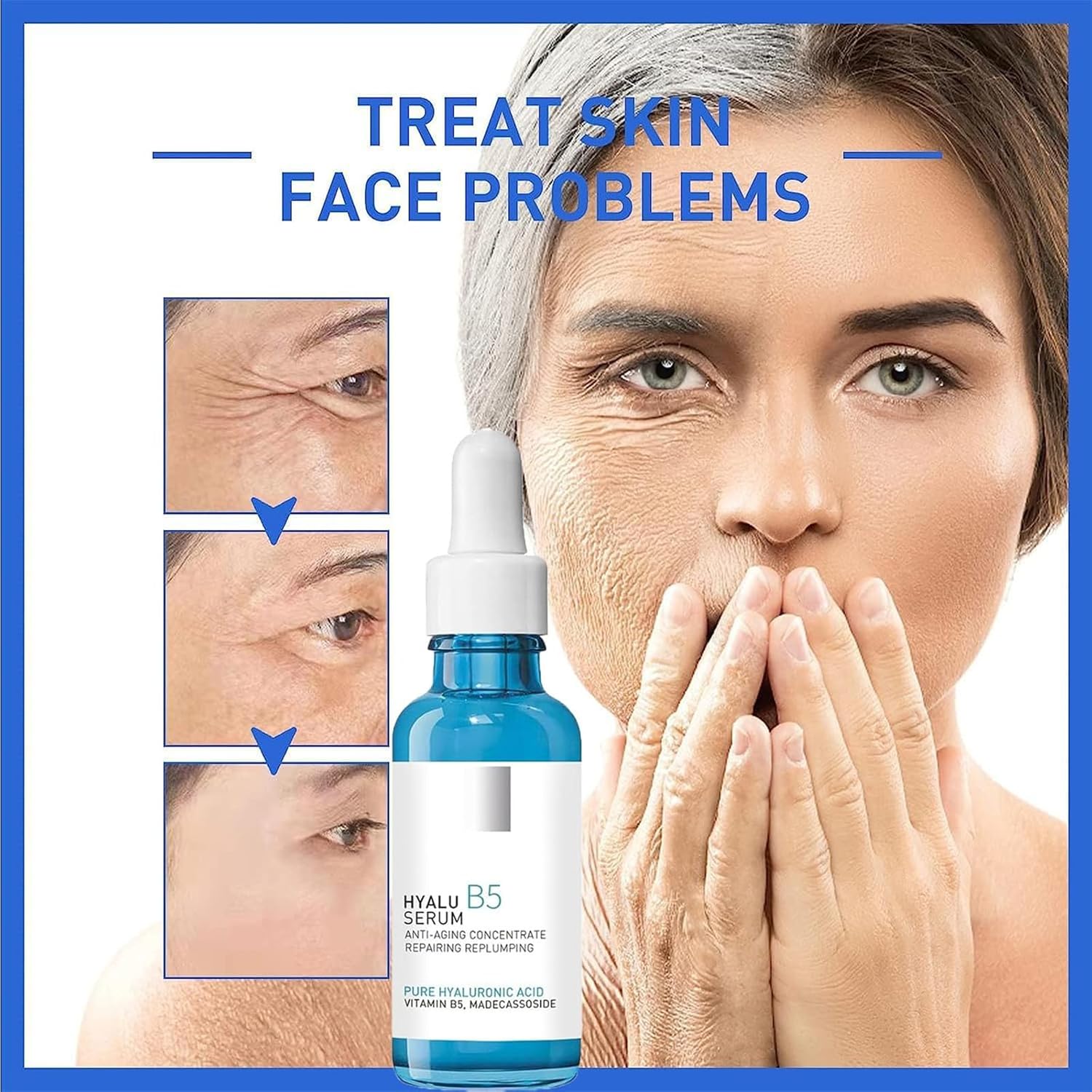 1+1 GRATIS | Hyalu™ Jugendliche Ausstrahlung wiederherstellen