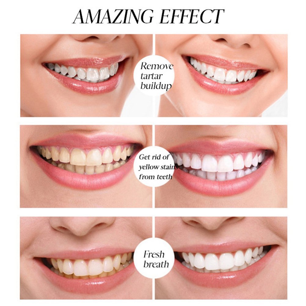 1+1 Gratis | SmileWhite™ Für strahlend weiße Zähne und gesundes Zahnfleisch