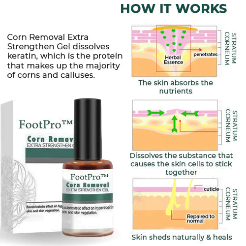 FootPro™ Hühneraugenentferner Gel | Extra Stark & Schmerzfrei | 1+1 Gratis