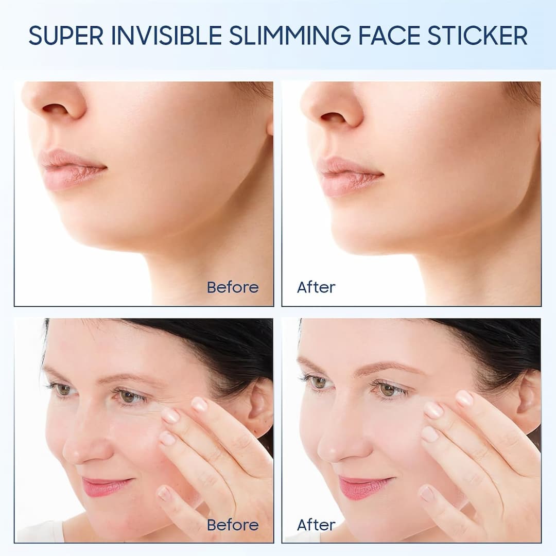 LiftEase™ - Unsichtbare, straffende Behandlung!