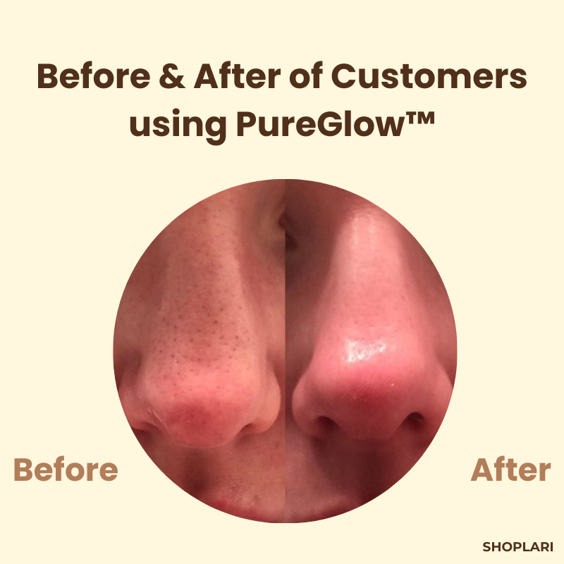 1+1 Gratis | PureGlow Schwarztee-Maske™ Reduziert Falten und feine Linien für jugendliche Haut