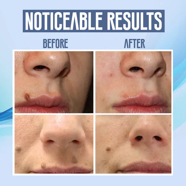 ClearRadiance™ — Unreinheiten wegzaubern für jeden Tag strahlend makellose Haut