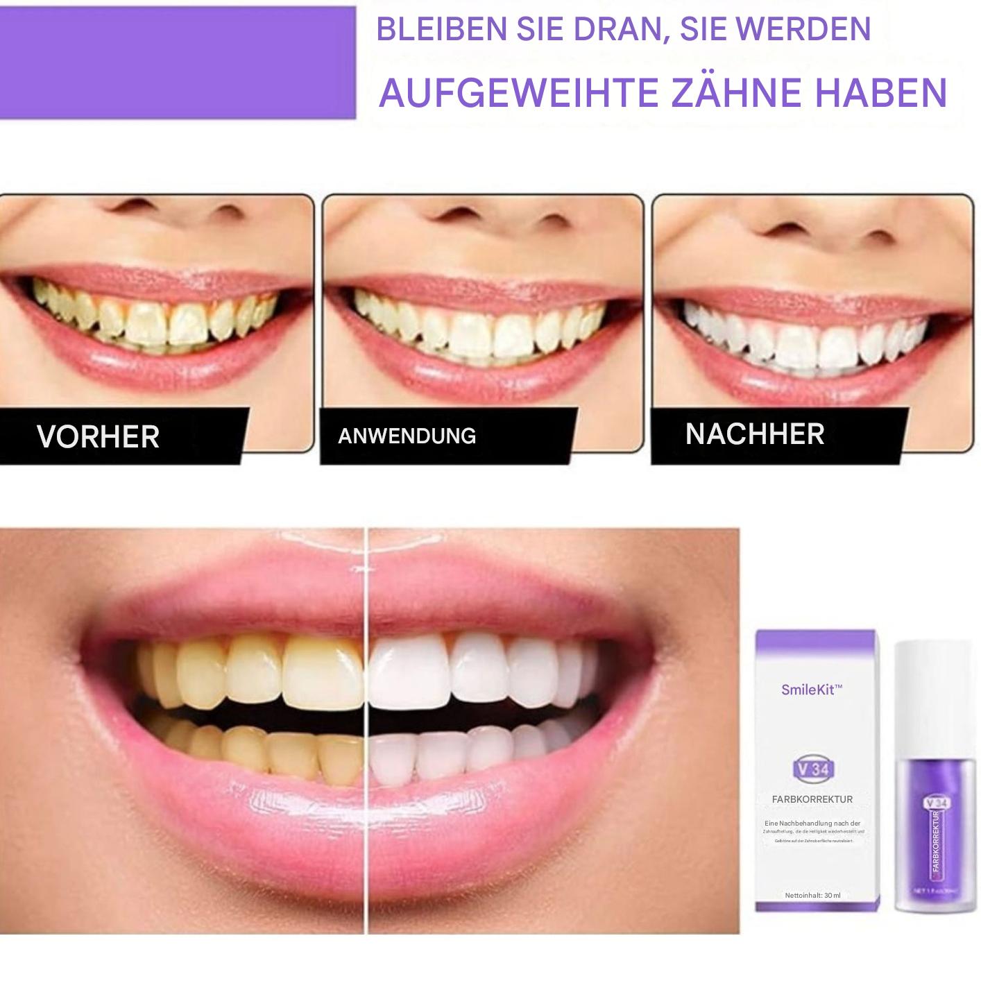1+1 GRATIS I SmileKit™ Fühlen Sie sich selbstbewusster mit einem frischen, strahlenden Lächeln, das lange anhält