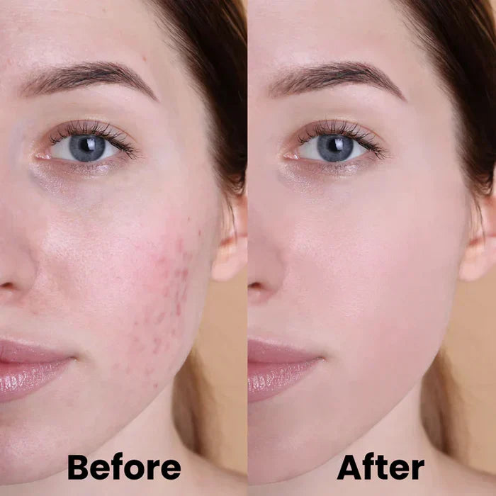 Kurkuma & Kojisäure Reinigungspads | 1+2 GRATIS