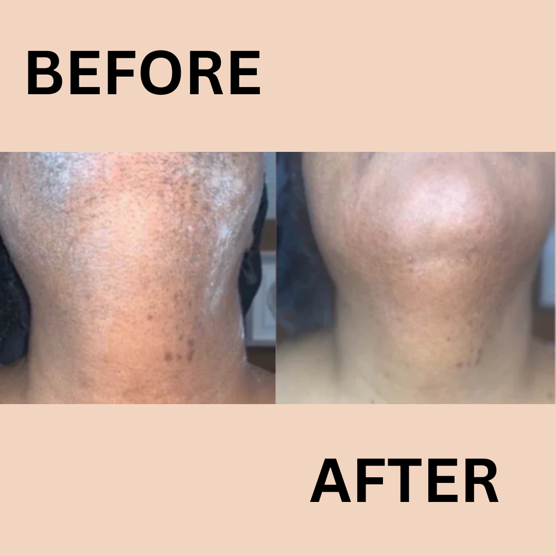 BareSmooth™ | Enthaarungscreme für Frauen