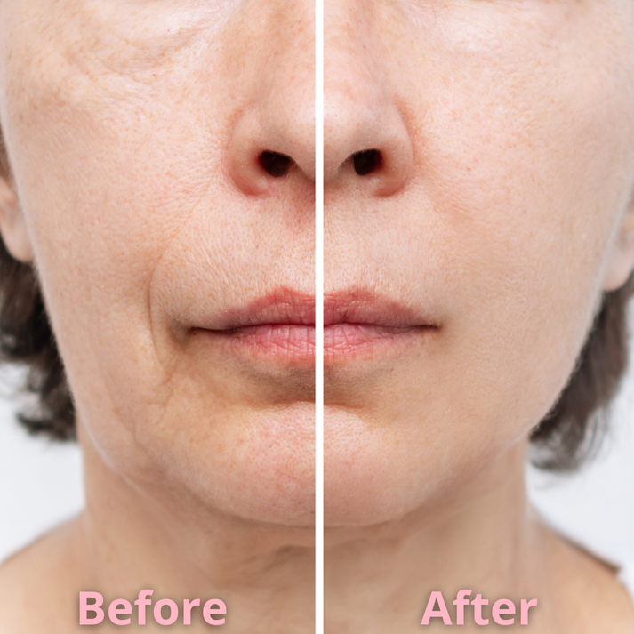 GlowPatch™ - Gezielte Anti-Falten-Lösung für jugendliche Haut