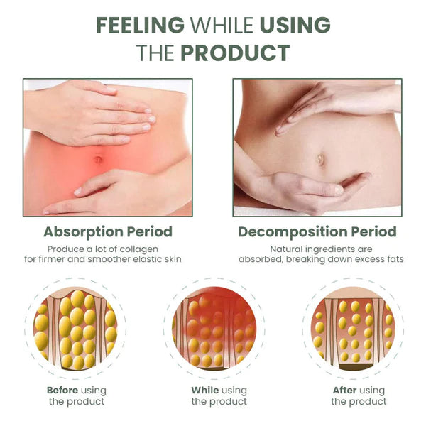 1+1 Gratis | CelluVanish™ Fortschrittliche Anti-Cellulite-Straffungscreme