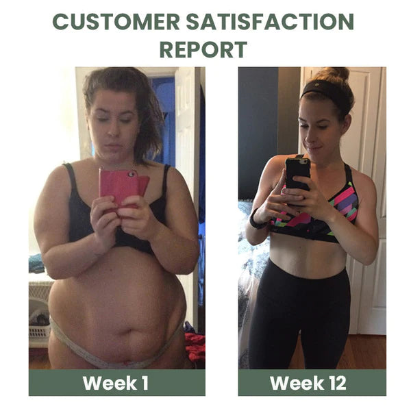 1+1 Gratis | CelluVanish™ Fortschrittliche Anti-Cellulite-Straffungscreme