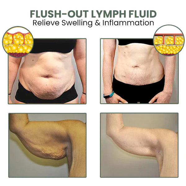 1+1 Gratis | CelluVanish™ Fortschrittliche Anti-Cellulite-Straffungscreme