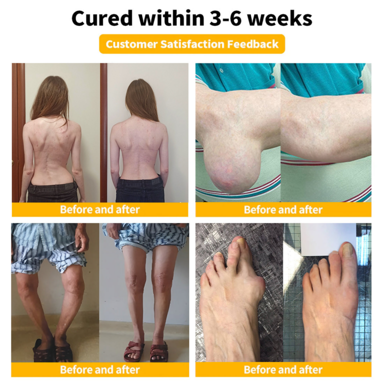 1+1 GRATIS | Knochenheilungs-Creme | Klinisch Erprobt gegen Gelenkschmerzen | Mit Bienengift & Arnika | Orthopädisch Zertifiziert