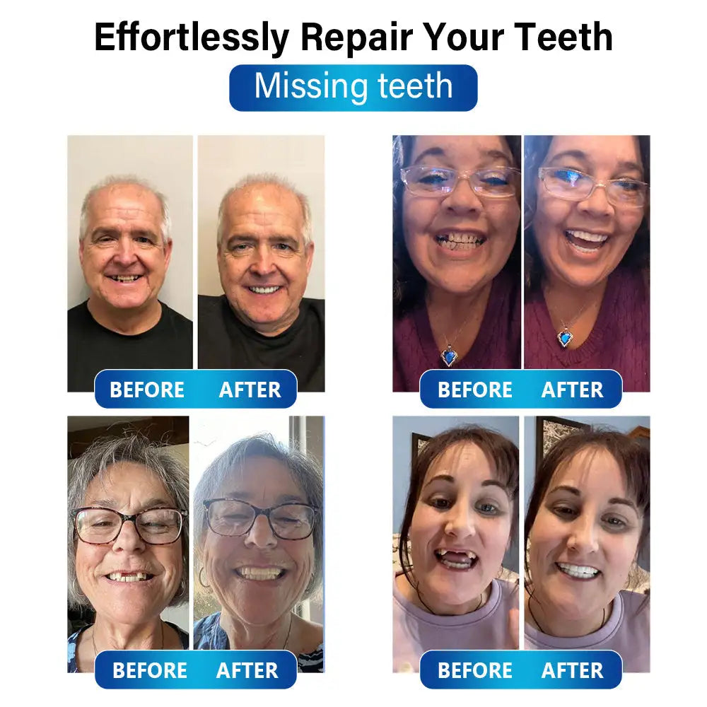 Futusly™ - Die preiswerte und einfache Lösung für Ihre Zahnprobleme