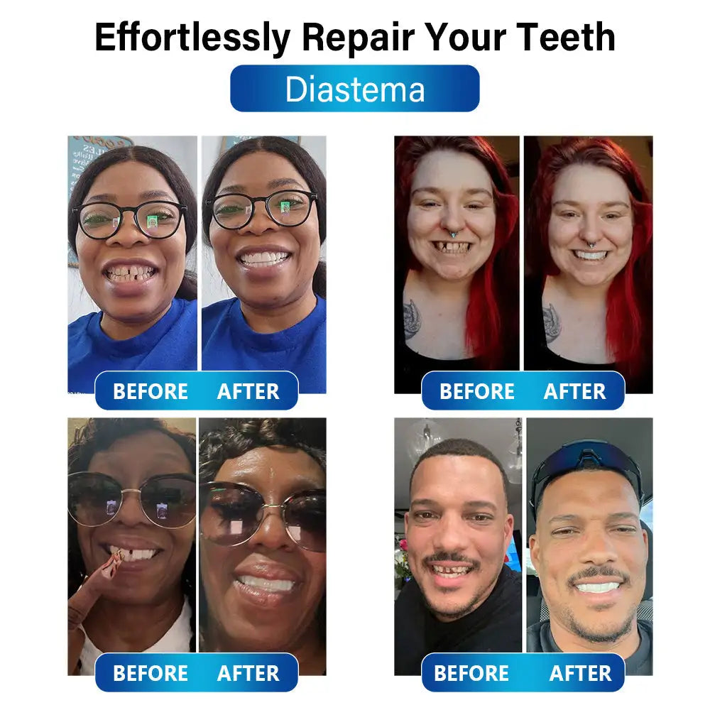 Futusly™ - Die preiswerte und einfache Lösung für Ihre Zahnprobleme