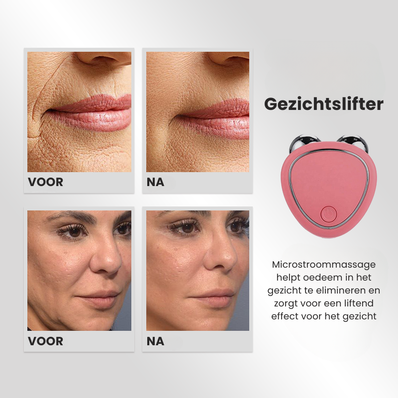 SkinVivo™ - Gesichtsmassagegerät