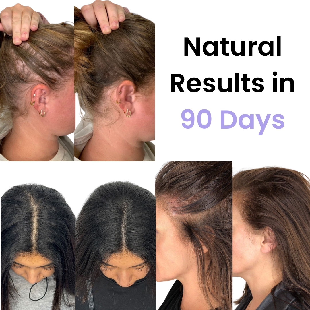 TheraBrush™ | Haarwiederherstellungswerkzeug