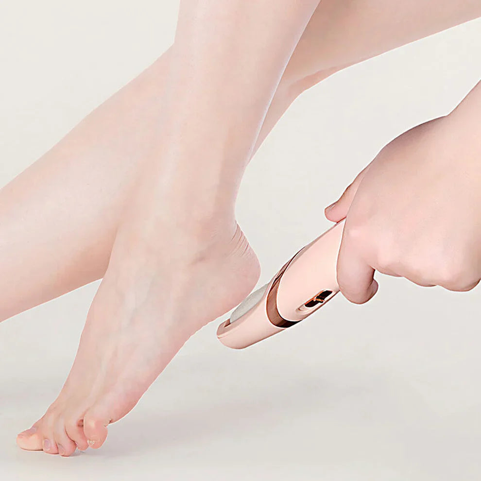 SoftTouch Fußerneuerer — Seidig glatte Füße im Handumdrehen