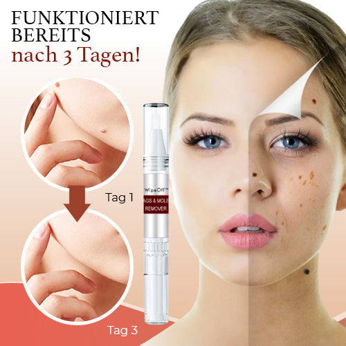WipeClear™ Tags & Maulwurfsentferner (1+1 Gratis)