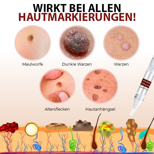 WipeClear™ Tags & Maulwurfsentferner (1+1 Gratis)