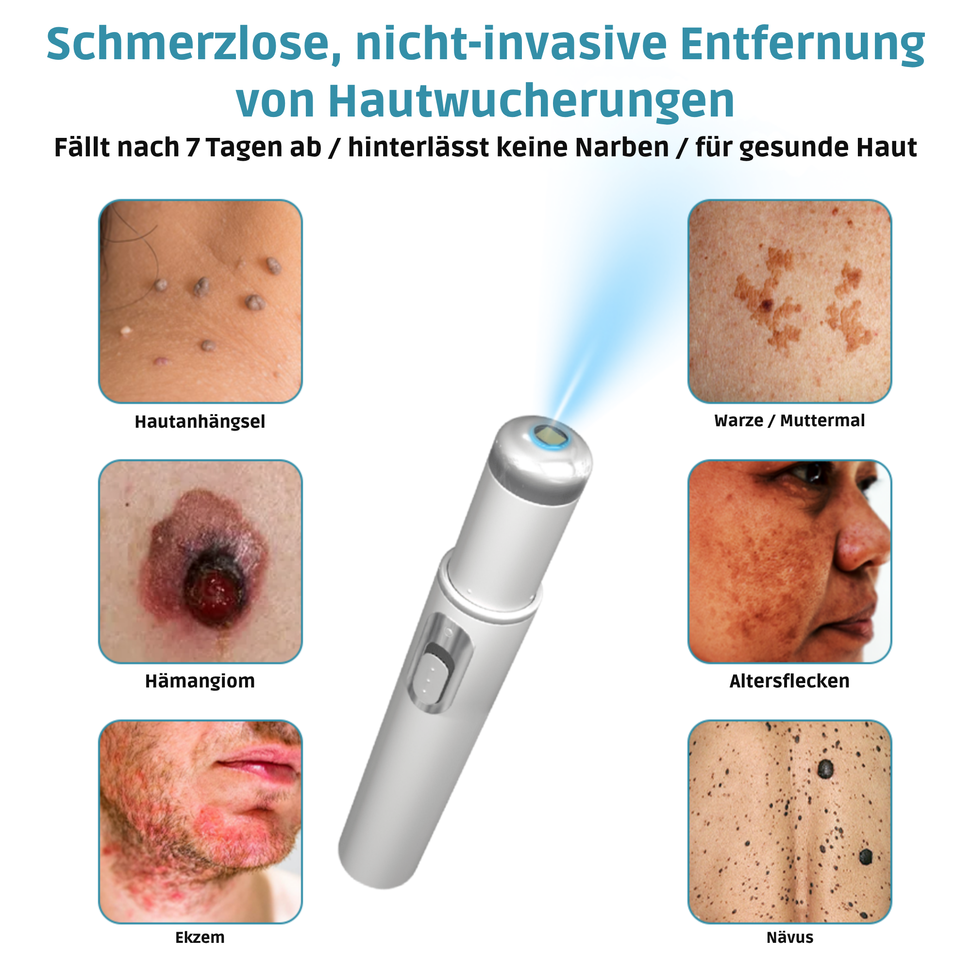 Klara™ Schmerzfreier Laser-Stift — Enthülle jederzeit makellose Haut und Selbstvertrauen