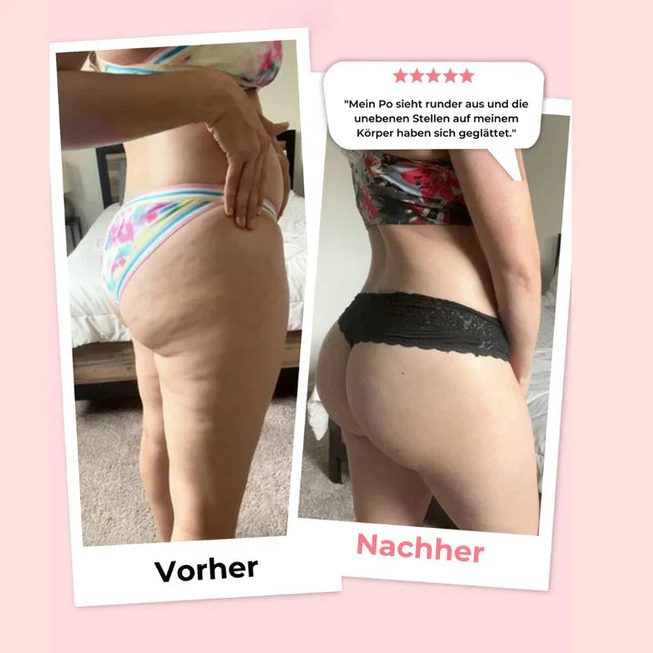 SculptFusion™, Makellose Haut, weniger Aufwand