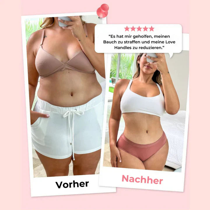 SculptFusion™, Makellose Haut, weniger Aufwand