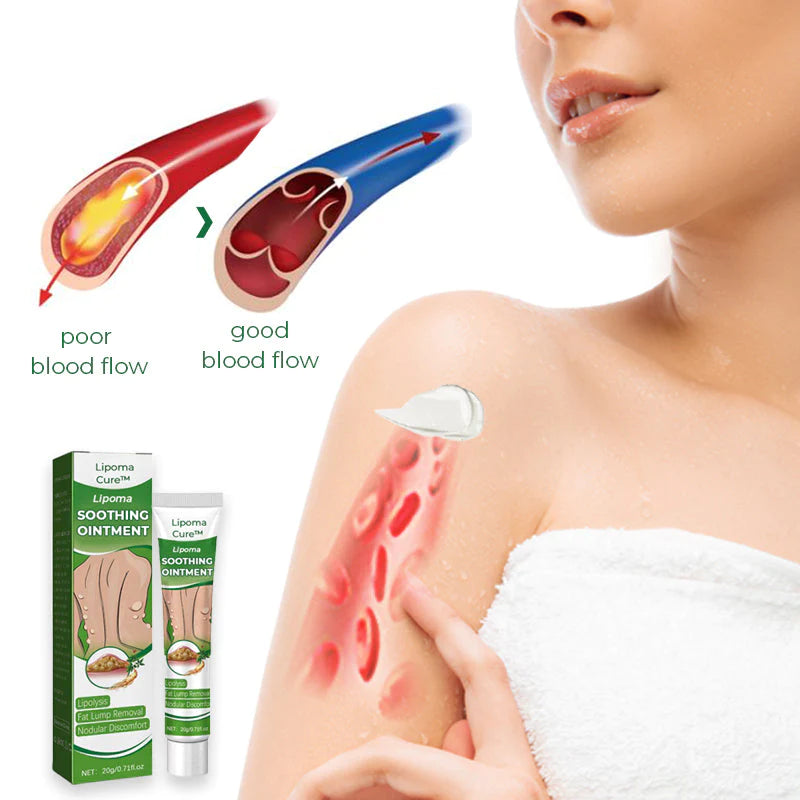 LipomaCure Salbe | Gegen Lipome & Schwellungen | Pflanzlich & Tiefenwirksam | 1+1 Gratis
