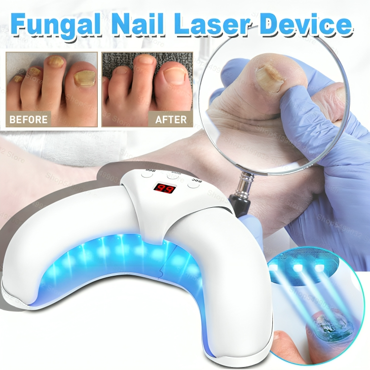 NailRenew™ | Nagelpilz bekämpfen und beseitigen!