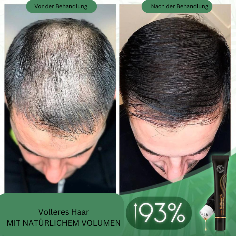 Regrowth™ Bio-Haar-Serum-Roller (1+1 gratis)